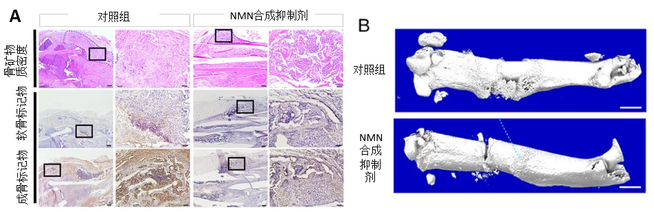 NMN/NAD+对骨折修复至关重要