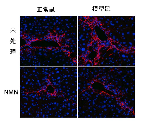 NMN实验|美国科学家发现NMN与长寿蛋白相互作用,可改善肝纤维化插图1 NMN实验模型鼠和正常小鼠的肝纤维化对比