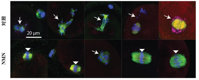 口服NMN后，老年雌性小鼠卵母细胞染色体结构变化