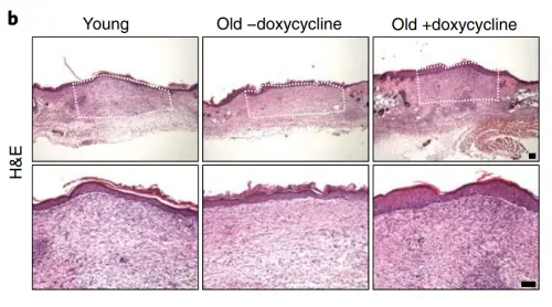 长期利用细胞重编程技术可减少老年小鼠皮肤伤口愈合过程中纤维组织的形成